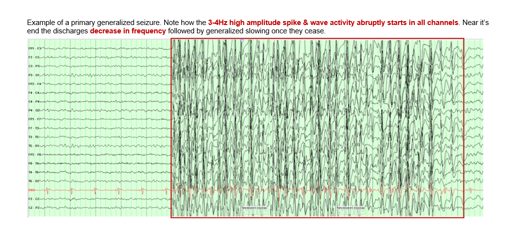 Teaching Medicine - Tutorial: EEG